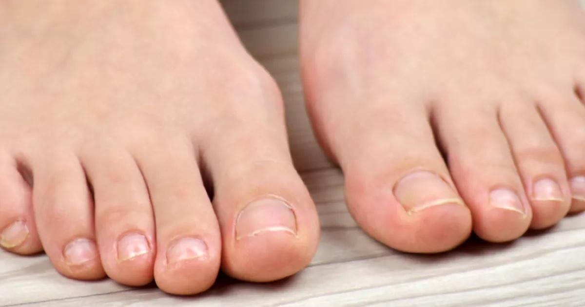 Como Acelerar o Crescimento das Unhas do Pé